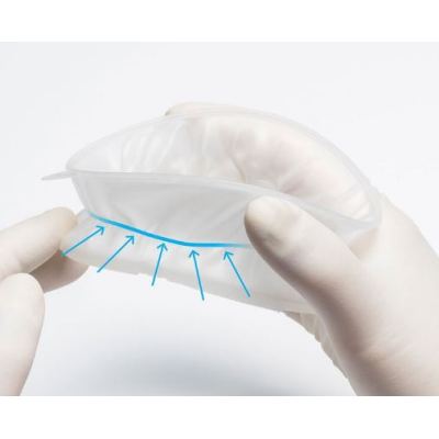 OptraGate 2 Ivoclar