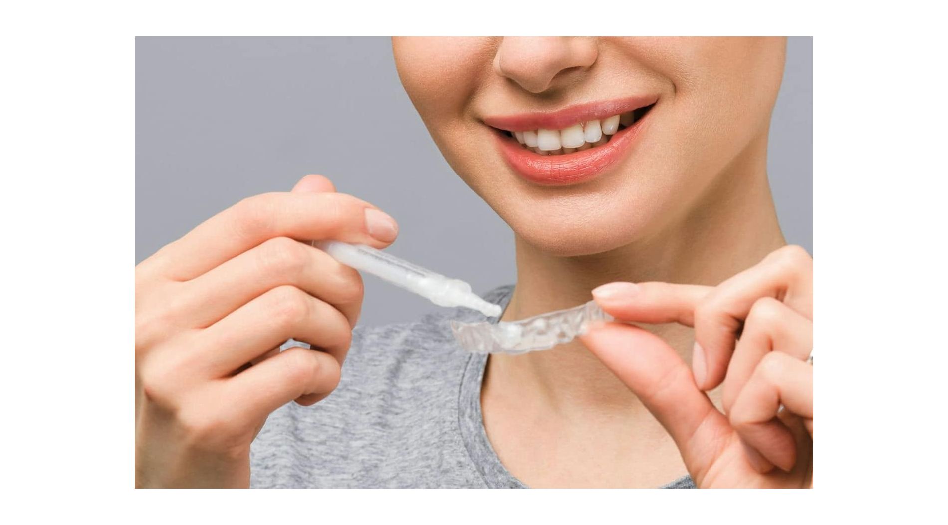 Wybielanie zębów za pomocą Opalescence - co warto wiedzieć?