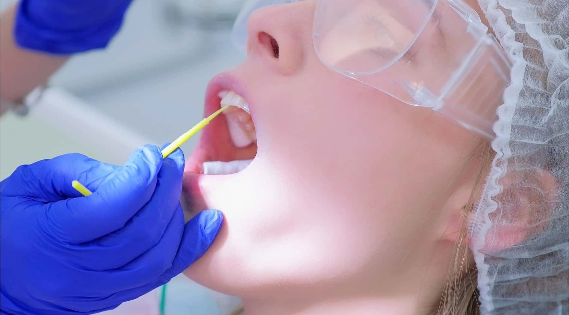 Fluoryzacja z użyciem Flairesse DMG: kiedy jest zalecana? 